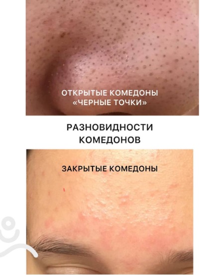 Изображение выглядит как текст, визитная карточка, Плоть, снимок экранаКонтент, сгенерированный ИИ, может содержать ошибки.